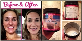 Best imported collagen product