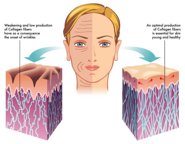 คอลลาเจน Type 1- เส้นทางสู่ผิวที่แข็งแรงและยืดหยุ่น